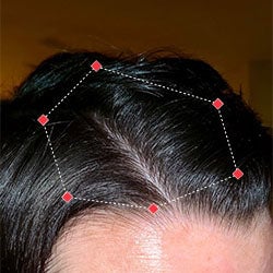 After image of a woman showing the her temples with more thicker hair.