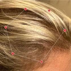 After image of a woman showing the her temples with more thicker hair.
