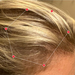 After image of a woman showing the her temples with more thicker hair.
