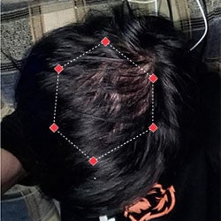 Top down view after image of a woman with thicker hair at her crown.