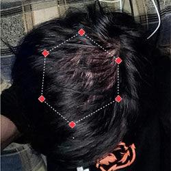 Top down view after image of a woman with thicker hair at her crown.