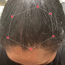 Top down view after image of a woman with thicker hair at the frontal region of her hair.