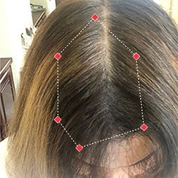 Top down view after image of a woman showing her hairline with growing more hair that fills the gap between her hairline. 