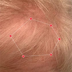 Top down view after image of a woman with thicker hair at the frontal region of her hair.