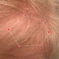 Top down view after image of a woman with thicker hair at the frontal region of her hair.