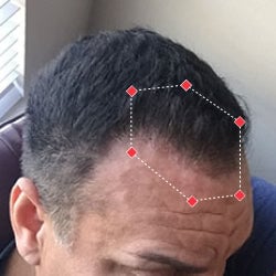 After image of a man with thicker hair at his hairline.