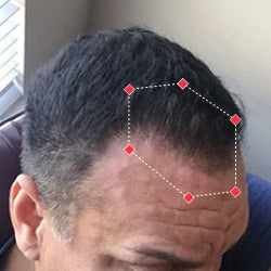 After image of a man with thicker hair at his hairline.