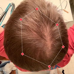 Top down view before image of a man with a thinning hair in his crown.