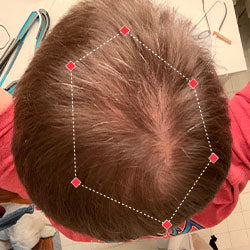 Top down view before image of a man with a thinning hair in his crown.