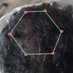 Top down view after image of a man showing the bald spot in his crown started to grow hair.