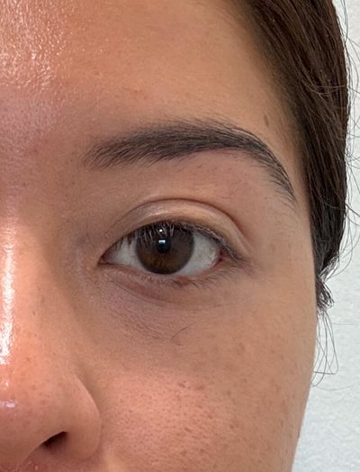 Close up shot of woman's eye area before using LED eye mask