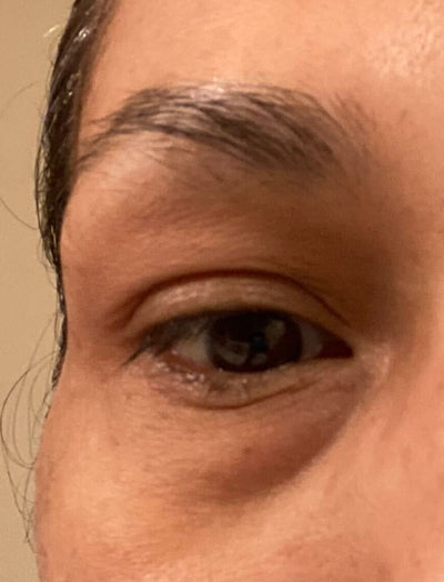 Close up shot of woman's eye area before using LED eye mask