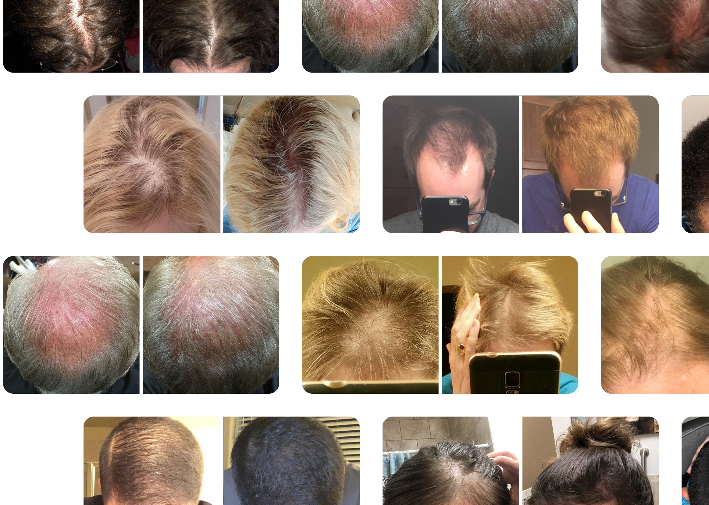 Collage of hair before and after comparison