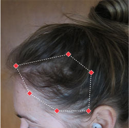 Before image of a woman with thinning hair at her temples.