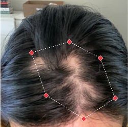 Top down view before image of a woman with bald spots in her frontal region of hair.