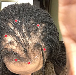 Top down view before image of a woman with thinning hair at the frontal region of her hair.