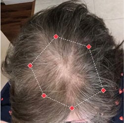 Top down view before image of a woman showing the widening part in her hairline.