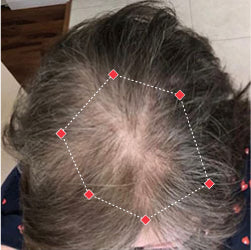 Top down view before image of a woman showing the widening part in her hairline.