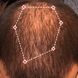 Top down view before image of a man with a thinning hair in his crown.