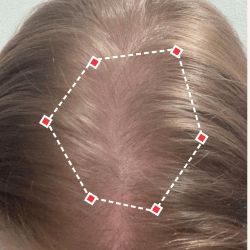 Top down view before image of a woman showing the widening part in her hairline.
