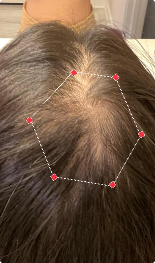 Top down view before image of a woman showing the widening part in her hairline.