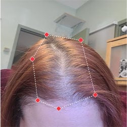 Top down view before image of a woman showing the widening part in her hairline.