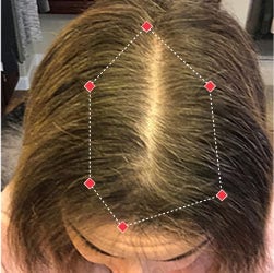 Top down view before image of a woman showing the widening part in her hairline.