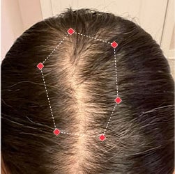 Top down view before image of a woman showing the widening part in her hairline.