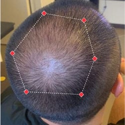 Top down view before image of a man with a thinning hair in his crown.