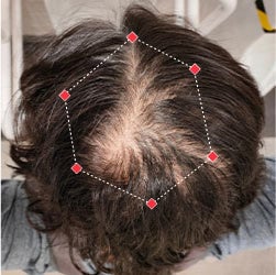 Top down view before image of a man with a thinning hair in his crown.