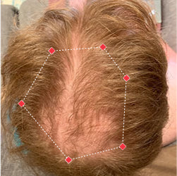 Top down view before image of a man with a thinning hair in his crown.