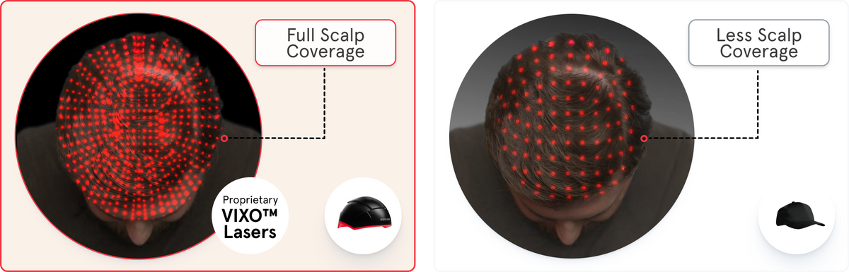 A side by side image comparing the coverage of iRESTORE compared to other laser cap. The left image shows the iRESTORE lElite device has full scalp coverage while the right image shows the laser cap with less scalp coverage.