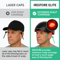 An image comparing the iRESTORE Elite with other laser cap. Laser caps only have less scalp coverage, laser caps may fail to reach all of the thinning hairs on the sides and back of scalp. While the Elite device have extended scalp coverage. it provides maximum scalp coverage to treat a much larger area of thinning hair.