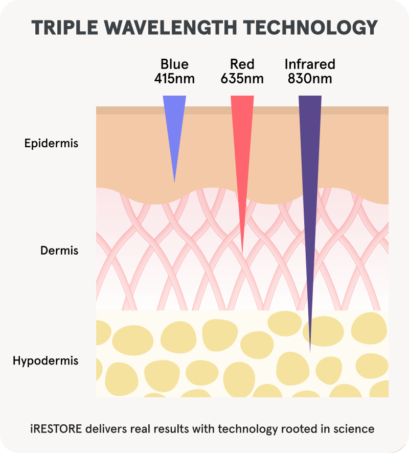 Illustration of Triple Wavelength Technology. Blue light penetrates the epidermis, Red light penetrates the dermis, and Infrared penetrates the hypodermis