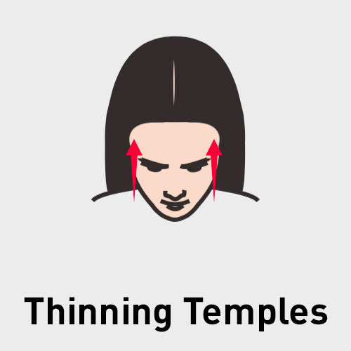Thinning Temples