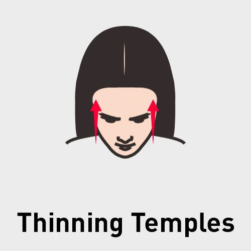 Thinning Temples