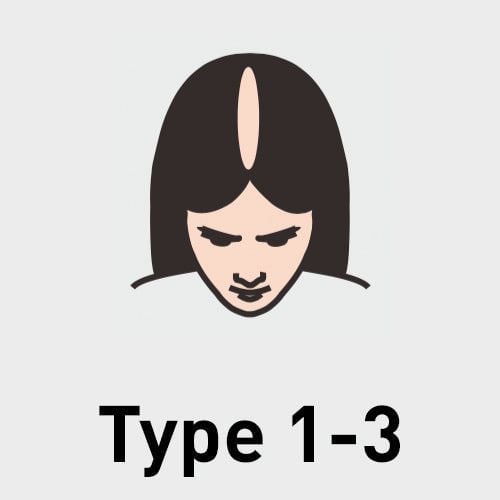 Type 1-3