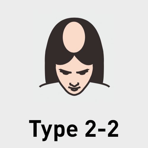 Type 2-2