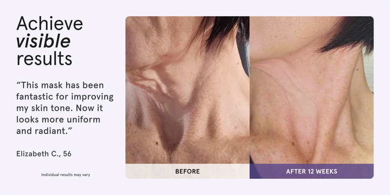Achieve visible results. Before and after comparison of a woman's neck showing skin improvement after 12 weeks. This mask has been fantastic for improving my skin tone. Now it looks more uniform and radiant. Elizabeth C., 56. Individual results may vary.
