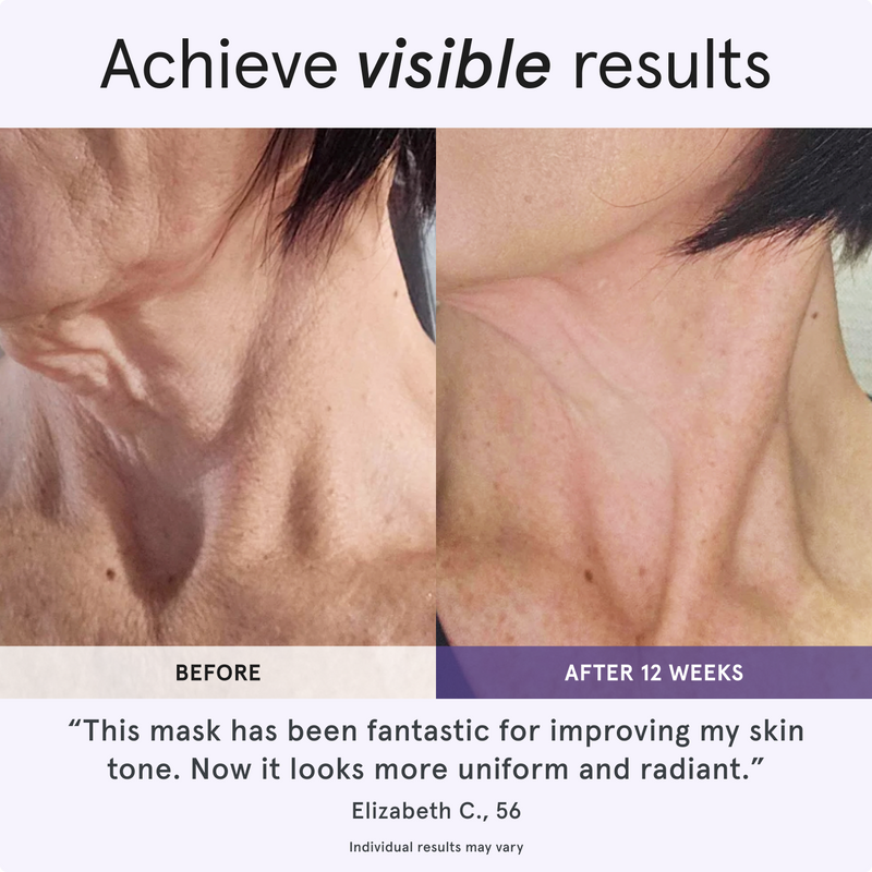 Achieve visible results. Before and after comparison of a woman's neck showing skin improvement after 12 weeks of using a product. This mask has been fantastic for improving my skin tone. Now it looks more uniform and radiant. Elizabeth C., 56. Individual results may vary.
