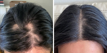 Hair Image