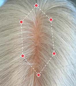 after image showing improved hair density