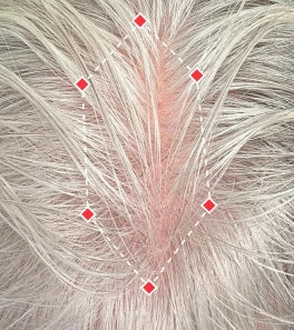 before image showing hair loss