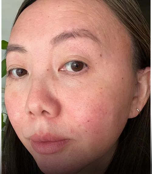 before image of woman's face