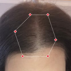 Top down view after image of a woman showing a more thicker hair at the frontal region of her hair.