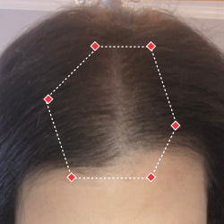 Top down view after image of a woman showing a more thicker hair at the frontal region of her hair.