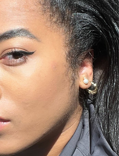 Side view after image of woman without acne and blemishes after 7 days of usage