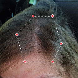 Top down view after image of a woman showing a more thicker hair at the frontal region of her hair.