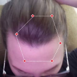 Top down view after image of a woman with thicker hair at the frontal region of her hair.