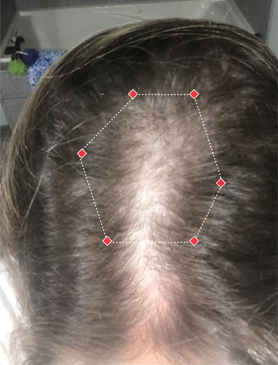 Top down view before image of a woman showing the widening part in her hairline.